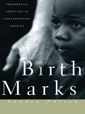cover image of Birthmarks